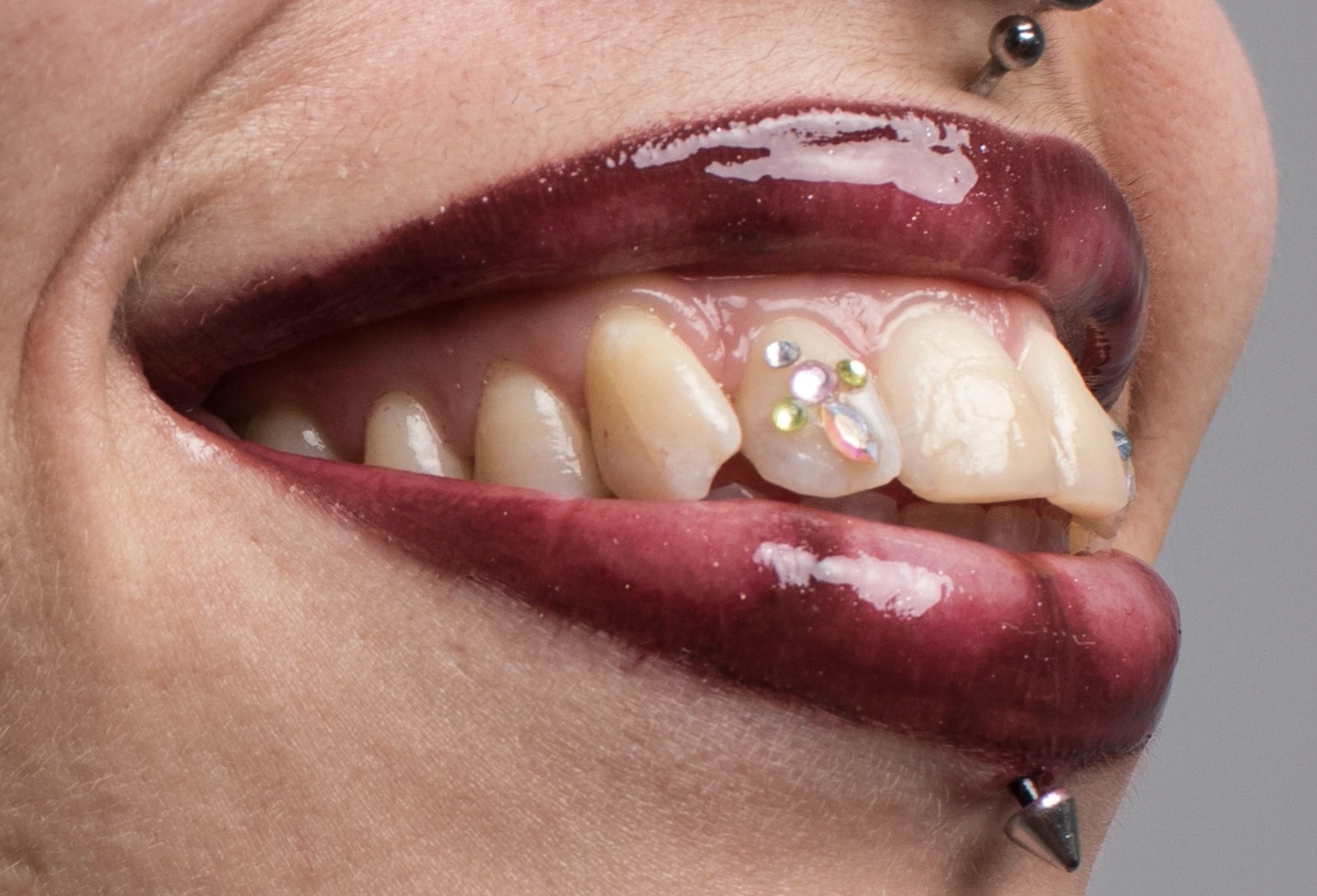 gemas dentales daga en valencia