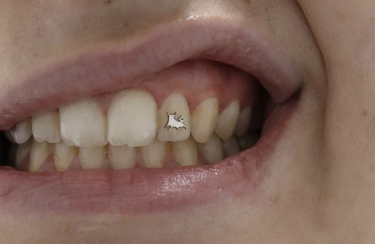 gemas para dientes en plata cerca de mi