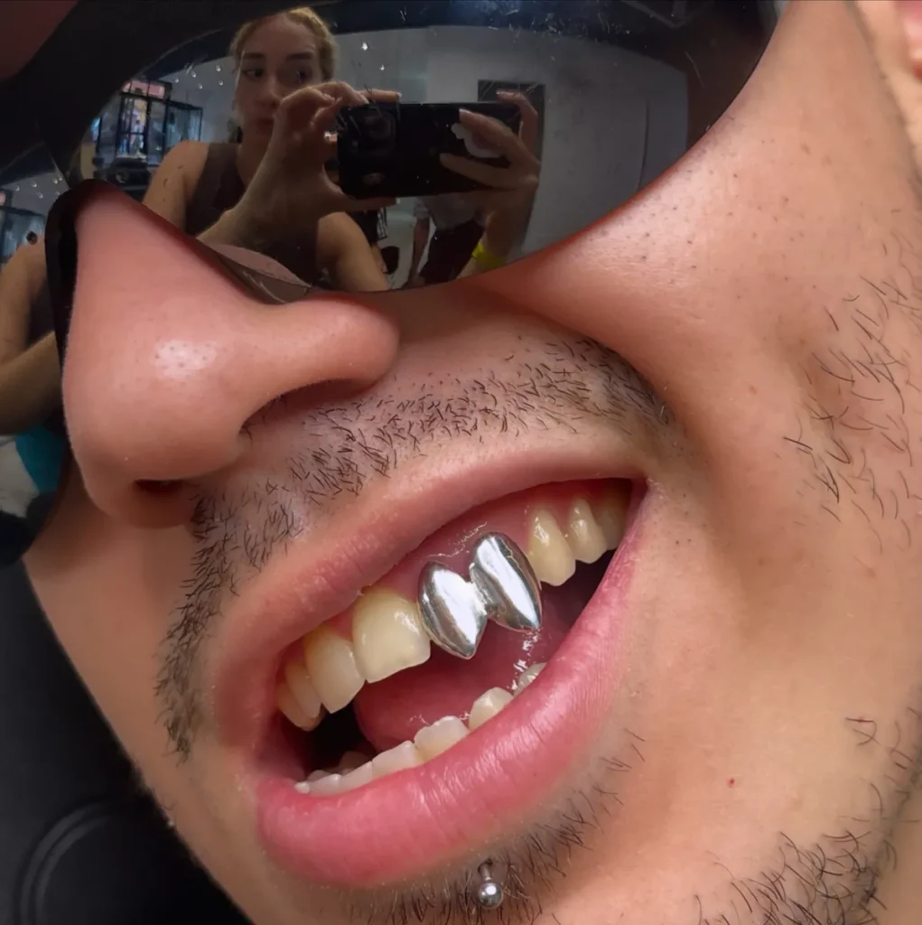 Grillz dientes en valencia